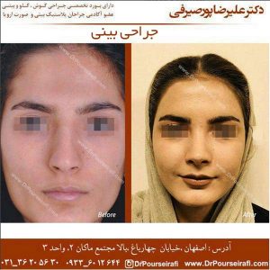 بهترین جراح بینی در اصفهان