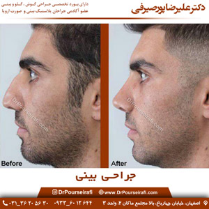 بهترین جراح بینی در اصفهان