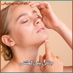 جراحی بینی گوشتی در اصفهان - دکتر پورصیرفی