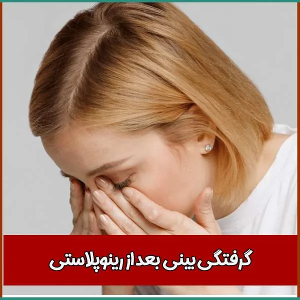 گرفتگی بینی بعد از جراحی