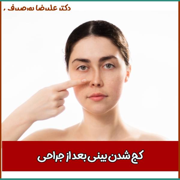 کج دیده شدن بینی بعد از عمل