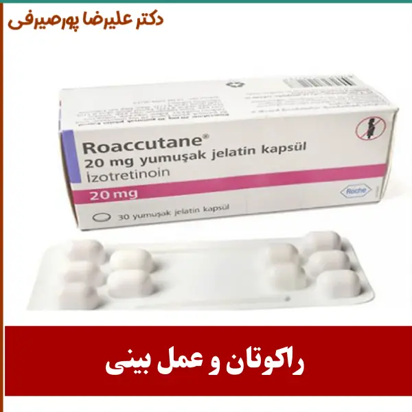راکوتان و عمل بینی _ دکتر علیرضا پورصیرفی