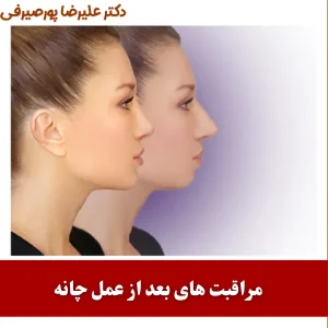 مراقبت های بعد از عمل چانه _ دکتر علیرضا پورصیرفی