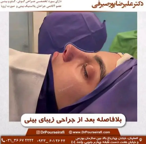 دکتر عمل بینی خوب در اصفهان _ دکتر علیرضا پورصیرفی