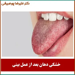 خشکی دهان بعد از عمل بینی _ دکتر علیرضا پورصیرفی