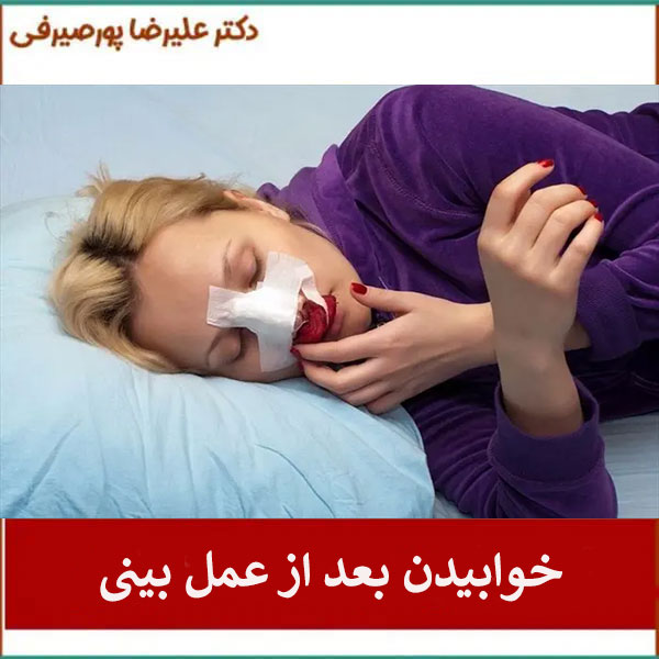 خوابیدن بعد از عمل بینی _ دکتر علیرضا پورصیرفی