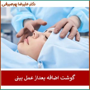 کلوئید بعد از عمل بینی _ دکتر علیرضا پورصیرفی