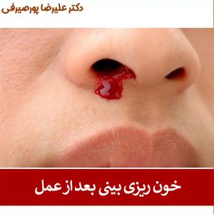 خون ریزی بعد از عمل بینی _ دکتر علیرضا پورصیرفی
