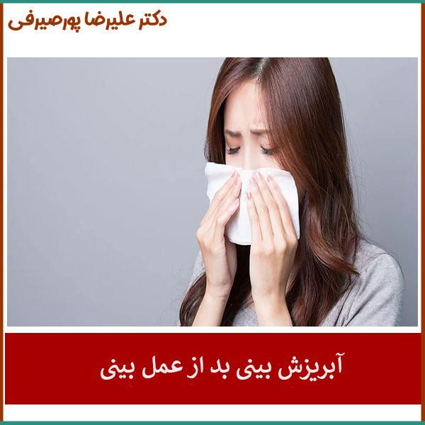 آبریزش بینی بعد از عمل _ دکتر پورصیرفی