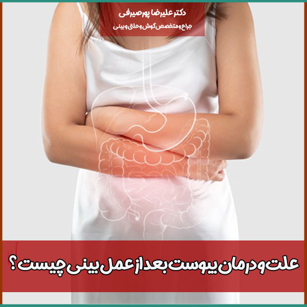علت و درمان یبوست بعد از عمل بینی چیست؟