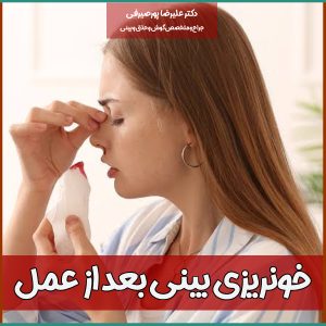 خونریزی بینی بعد از عمل | دکتر علیرضا پورصیرفی